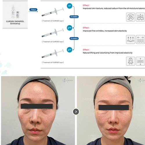 Curenex Eye PN revitalizing eye care with salmon DNA technology for improved skin elasticity and reduced wrinkles.