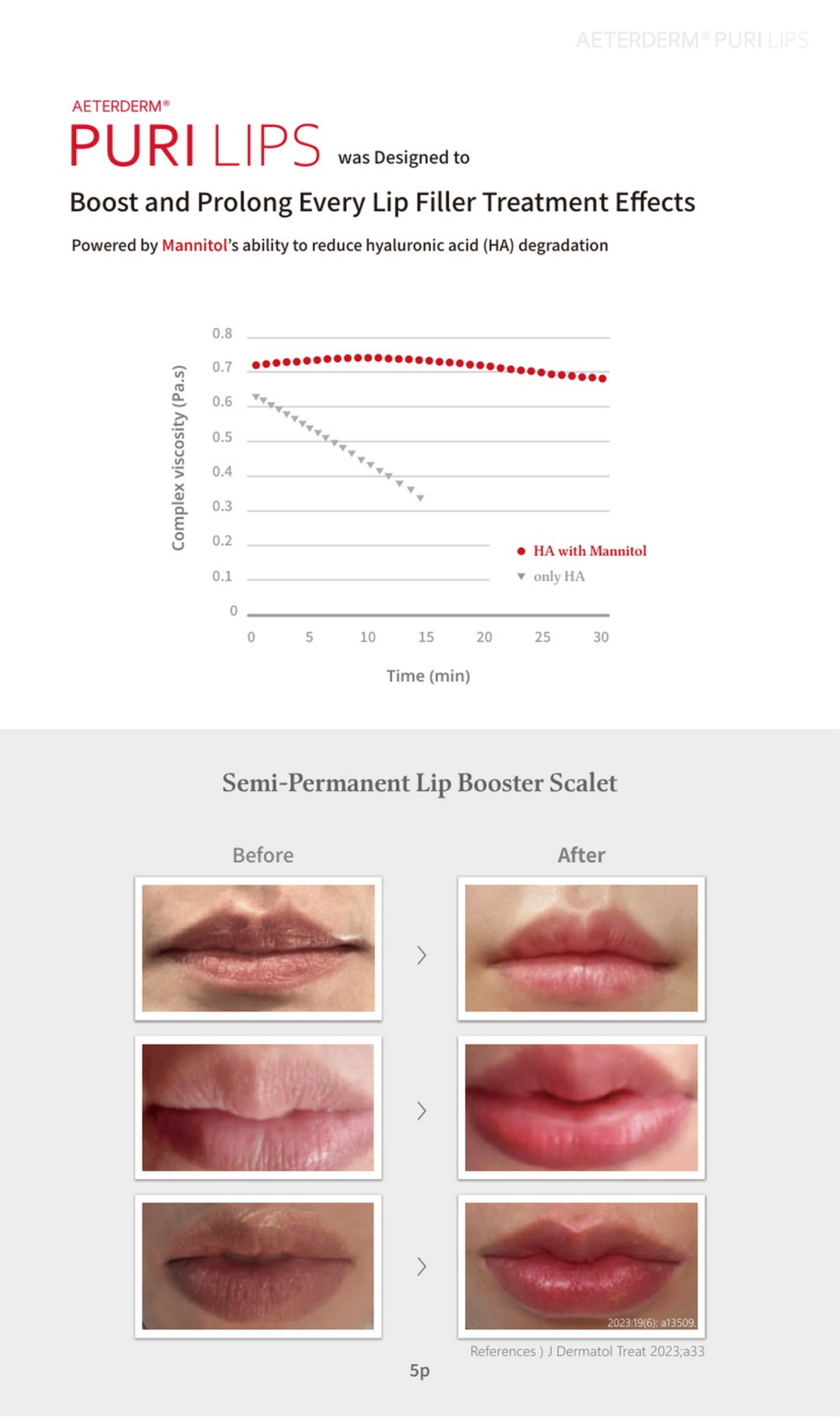 Puri Lips Lip Booster packaging and effectiveness chart for enhancing lip filler treatment results.